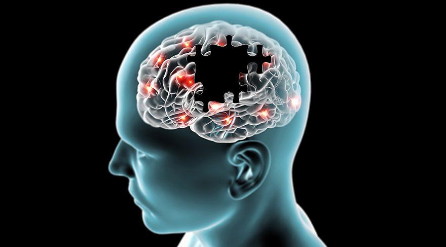 Alzheimer’ın belirtileri ve tedavisindeki son gelişmeler… O molekül mucize yaratacak mı?